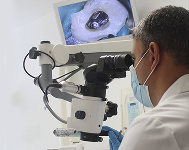 microscopíca en endondoncia