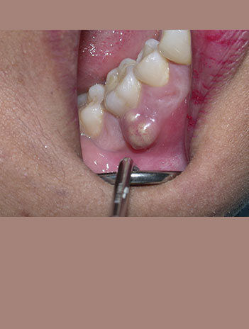 prevención y diagnostioc de patologia